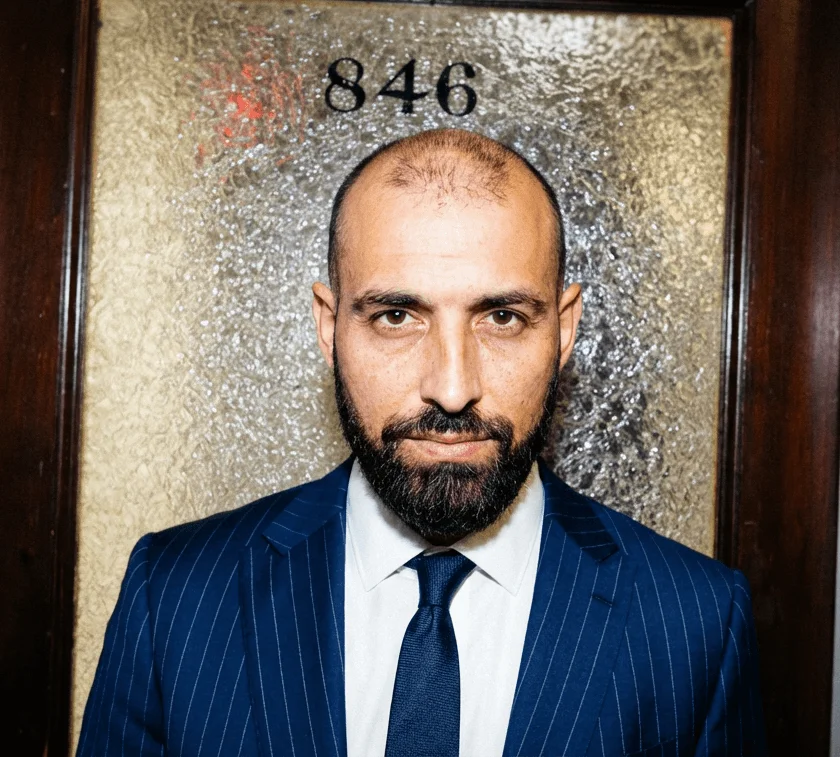 Sly Hair Transformation Before