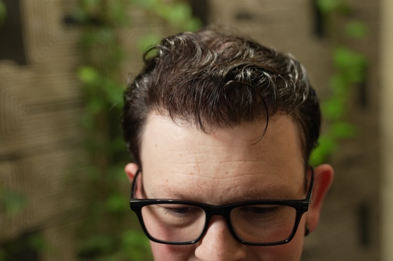 Transformation after photo 23