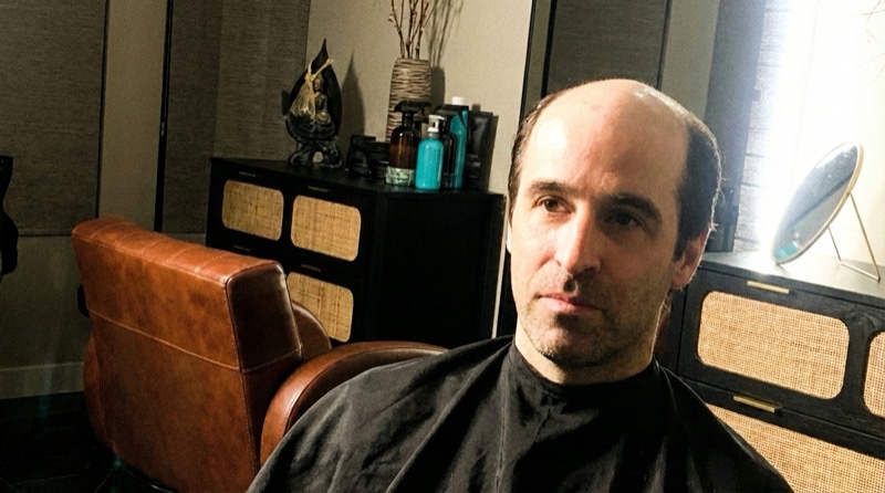 Transformation after photo 5